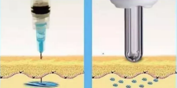 看完無針胰島素注射器的優(yōu)缺點