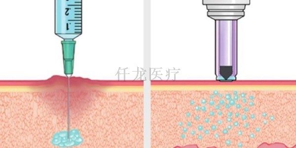 無針注射器應(yīng)用在哪方面