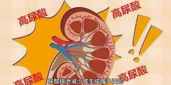 突然痛風(fēng)？別再只怪啤酒和燒烤！真正的“尿酸元兇”遠(yuǎn)比你想的多！