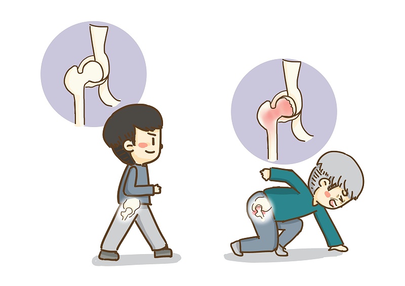 股骨骨折如何使用紗布繃帶包扎