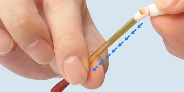 碘伏棉棒：一種常見的醫(yī)療消毒工具